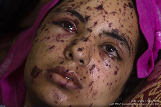 Conflict, Healing and Resilience in Gaza photo by Heidi Levine / Sipa Press