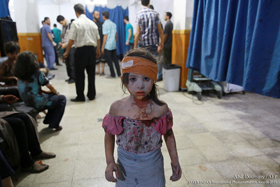 Syrian Children Cry for Help photo by Abd  Doumany / AFP
