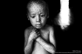 The HUMAN COST OF AGROCHEMICALS photo by Pablo Piovano