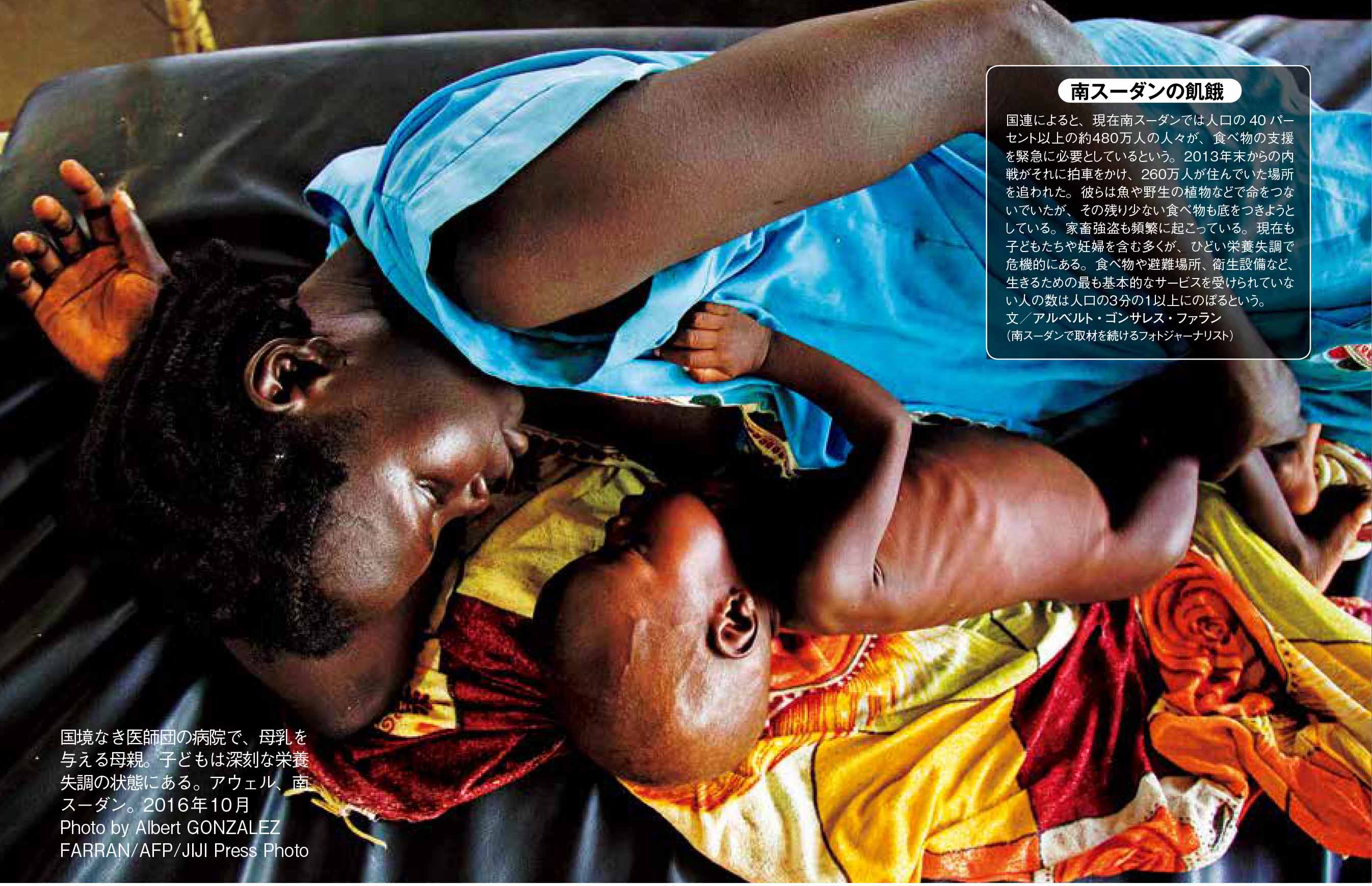 国境なき医師団の病院で、母乳を与える母親。子どもは深刻な栄養失調の状態にある。アウェル、南スーダン。2016年10月 Photo by Albert GONZALEZ FARRAN/AFP/JIJI Press Photo
